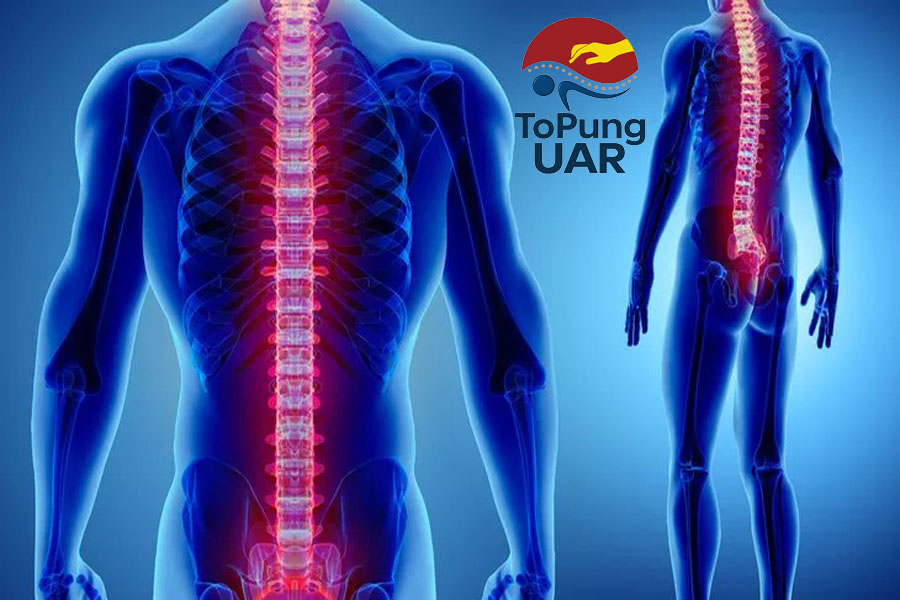 ToPungUAR